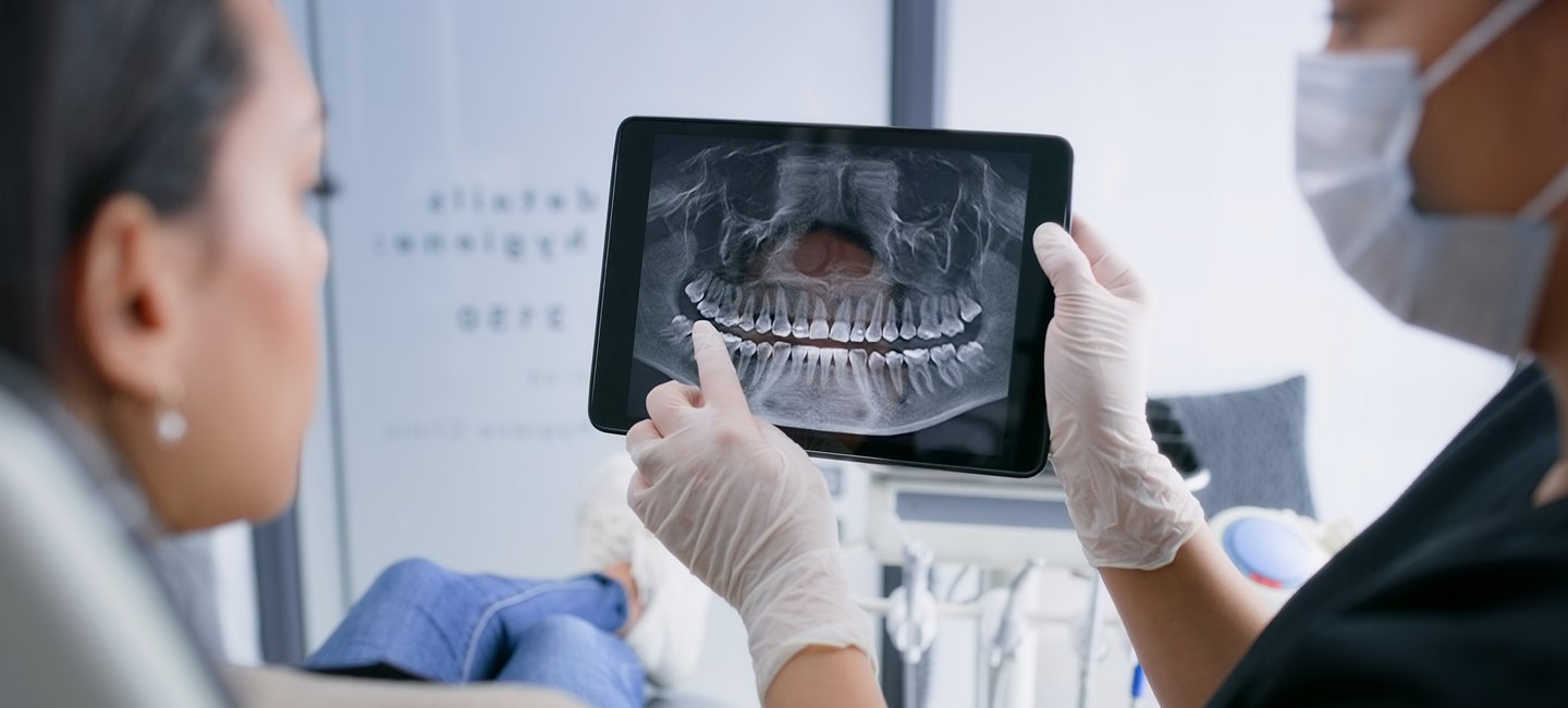 Digital X-Rays - Mack Orthodontics Eldridge, IA