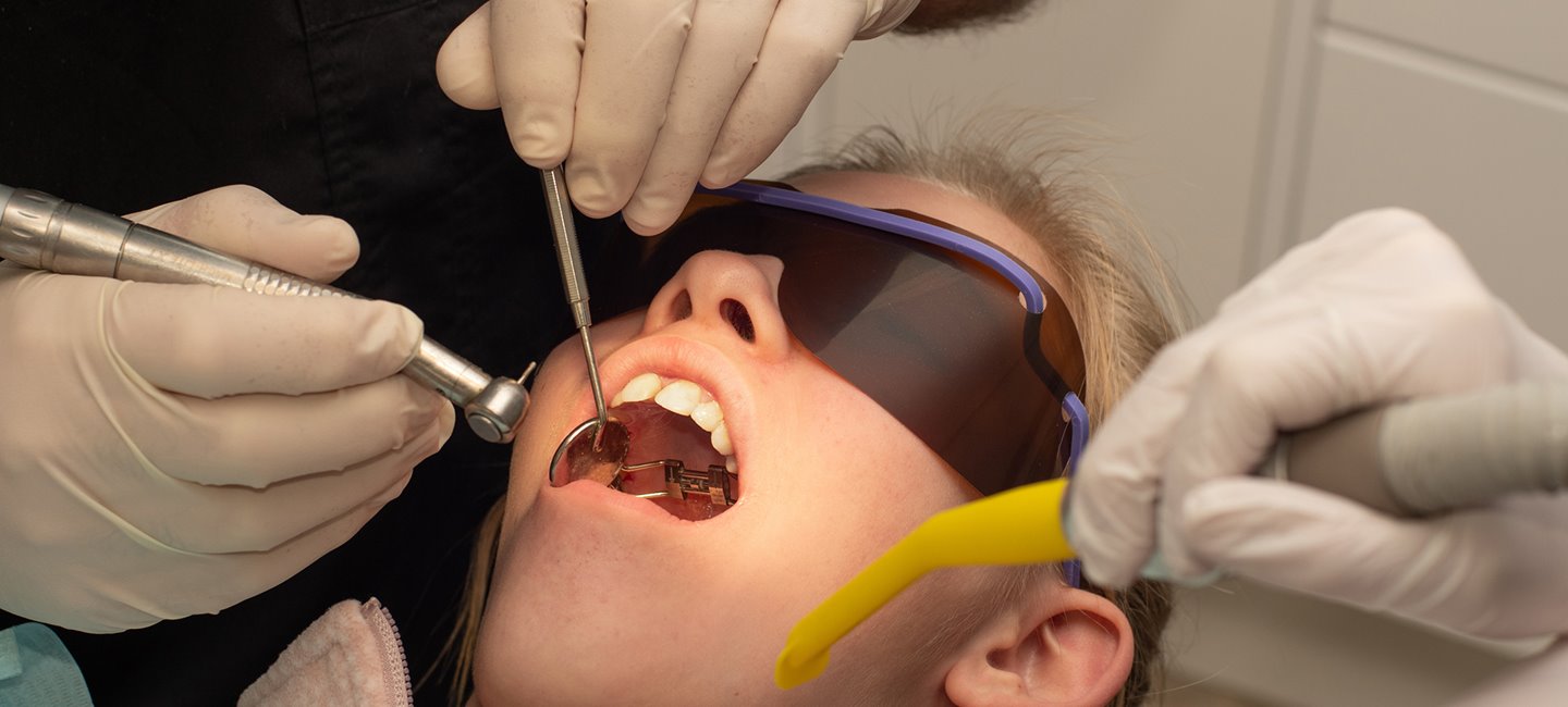 Palatal Expanders - Mack Orthodontics Bettendorf in Lowa