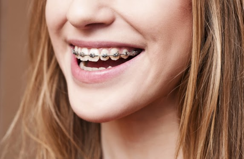 About Our Orthodontists